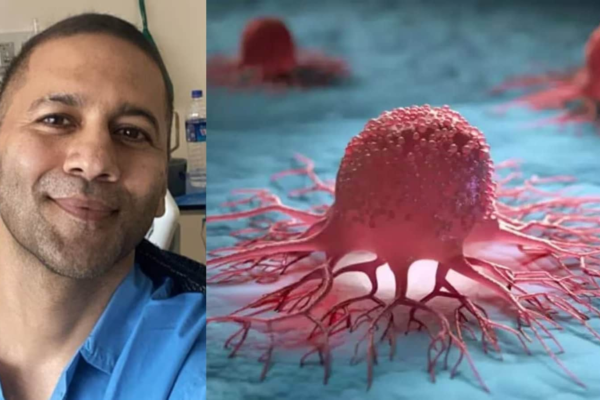 Colon Cancer: Know Early Symptoms To Stay Safe News18