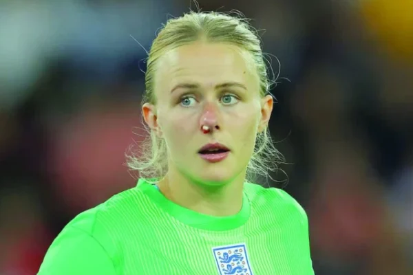england goalkeeper hannah hampton with blood on her nose photo reuters