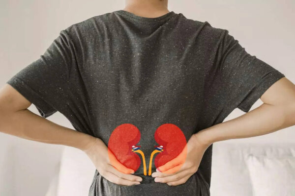 Kidney stones pain: How it’s different from usual back or gas pain