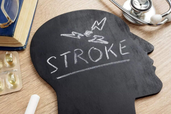 Stroke: People with THIS blood type face a higher risk of early-onset stroke | – Times of India