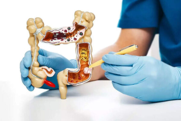 Why some colon cancers resist treatment: Understanding oncofetal reprogramming what did scientists discover | – Times of India