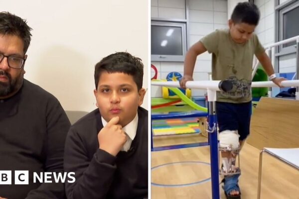 12-year-old patient harmed by GOSH surgeon talks about his ordeal