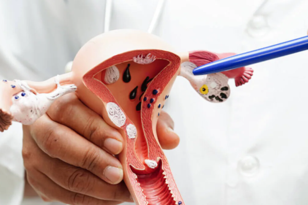 Expert Clears Myths That Are Stopping Women From Taking The Pap Smear Test