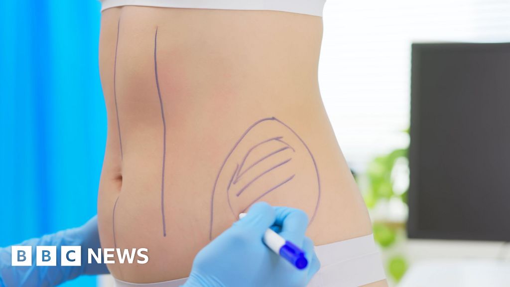 Harley Street plastic surgeon suspended for liposuction rule breaches