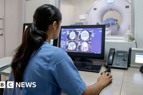 Menopause linked to Alzheimer's-like brain changes