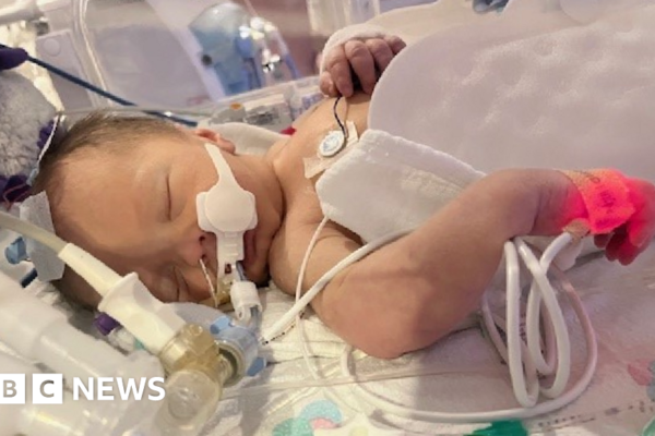 Newborn dies after failures in maternity care at Ysbyty Gwynedd in Bangor