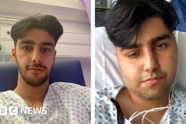 Relearning to walk and talk after a brain tumour