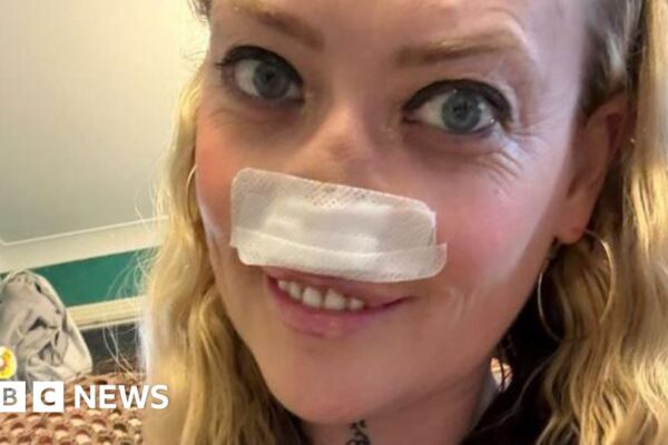 Telford botched "Turkey teeth" op victim keeps going advising of dangers