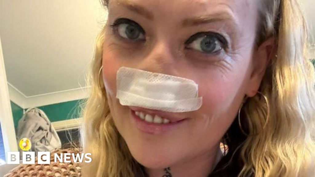Telford botched "Turkey teeth" op victim keeps going advising of dangers