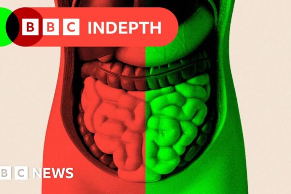 The curious question of whether gut health affects ageing