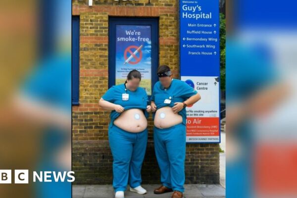Weight loss videos using AI doctors prompts hospital warning