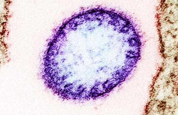 What to know about Nipah virus?