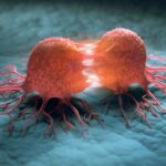 Colorectal Cancer Rising Among Under-50s as Experts Search for Answers - SUCH TV