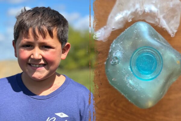 Dangerous TikTok trend leaves boy badly burned as doctors issue warning