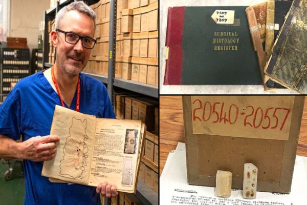 Doctors turn to UK archive can solve under-50s bowel cancer mystery - SUCH TV