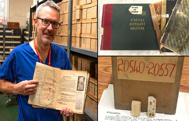 Doctors turn to UK archive can solve under-50s bowel cancer mystery - SUCH TV