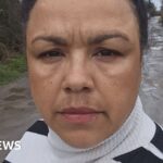 I woke up in agony from a vaginal mesh operation and the pain never went away