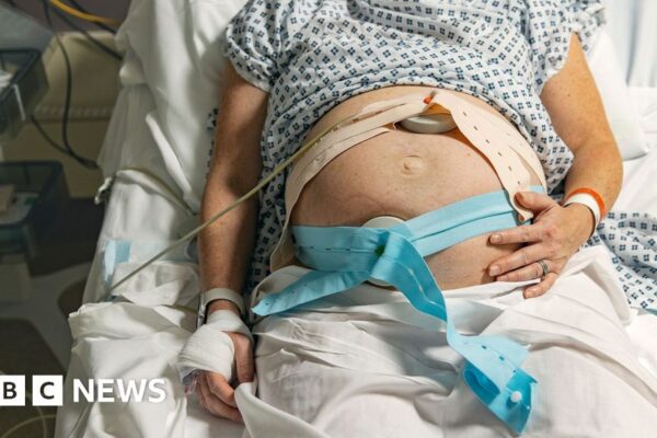 Racism and staffing issues factors in 'failing' maternity care, report finds