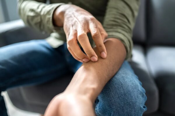 State confirms outbreak of sexually transmitted fungal infection, experts urge caution