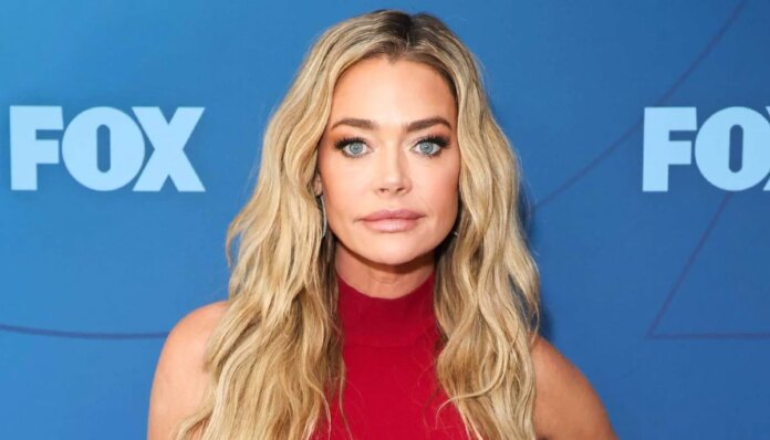 Denise Richards addresses unexpected changes after recent facelift
