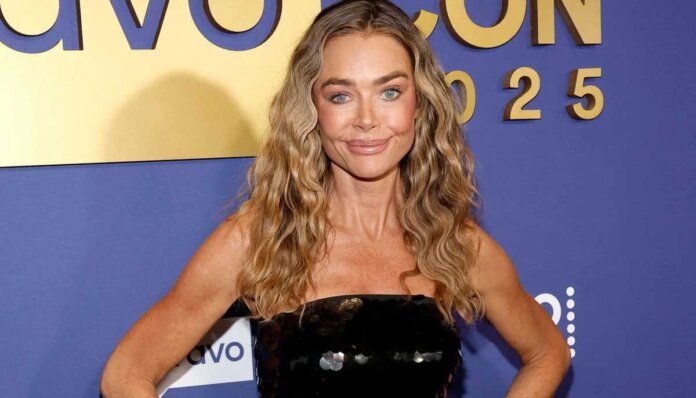 Denise Richards speaks out on surprising changes after undergoing facelift