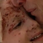 Inside a Beirut hospital treating wounded children