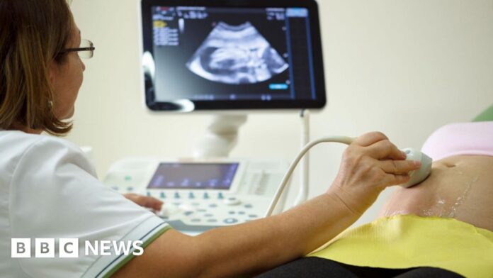 NHS scan delays putting some pregnant women at risk, experts warn