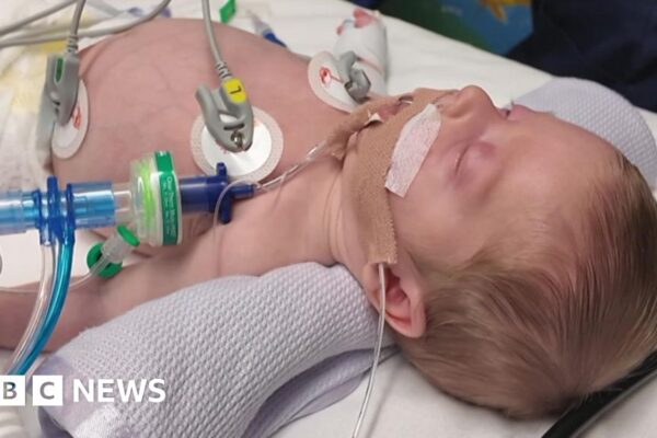 Paediatric transport team concerned by workload and funding