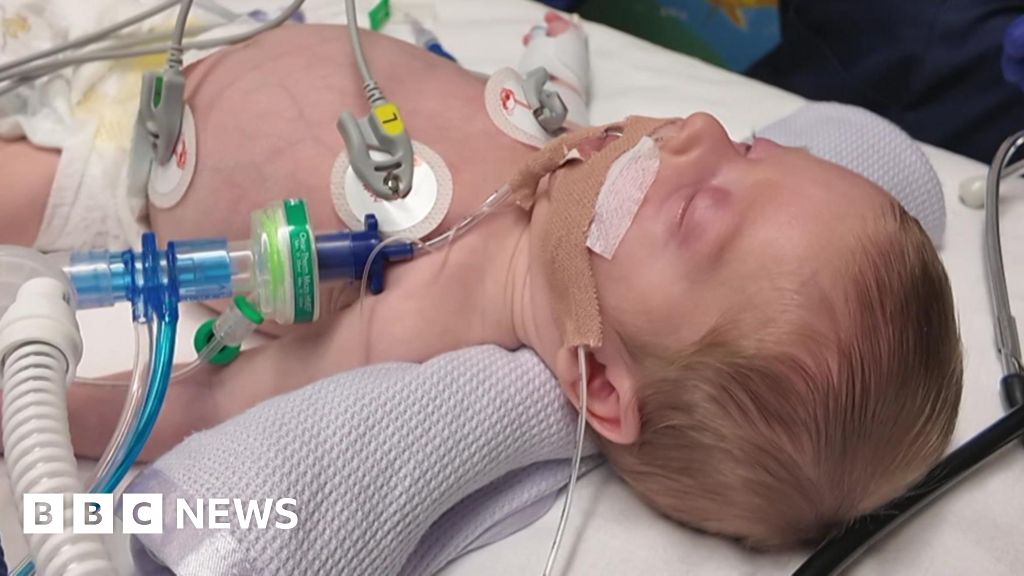 Paediatric transport team concerned by workload and funding