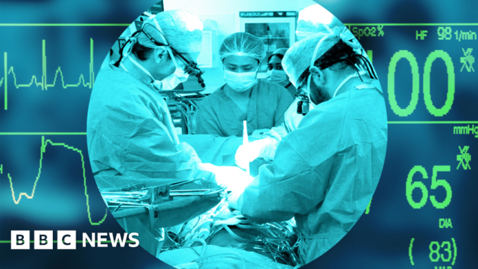 UK transplant system, once world-leading, now lags behind