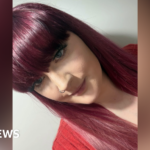 Worcestershire endometriosis study aims for safer diagnosis