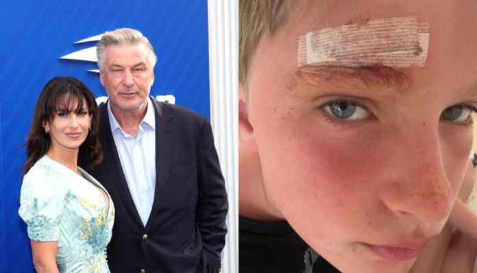 Alec, Hilaria Baldwin's son suffers scary incident amid family vacation