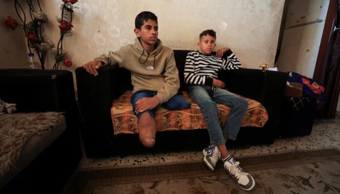 Gaza's war amputees short of prostheses under Israeli restrictions