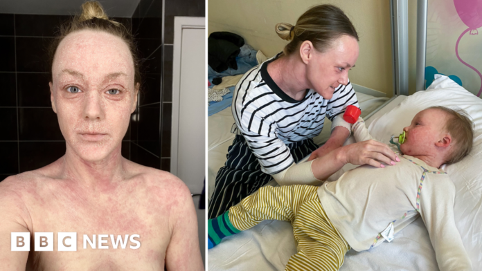 TSW: Hundreds contact BBC about mystery skin condition
