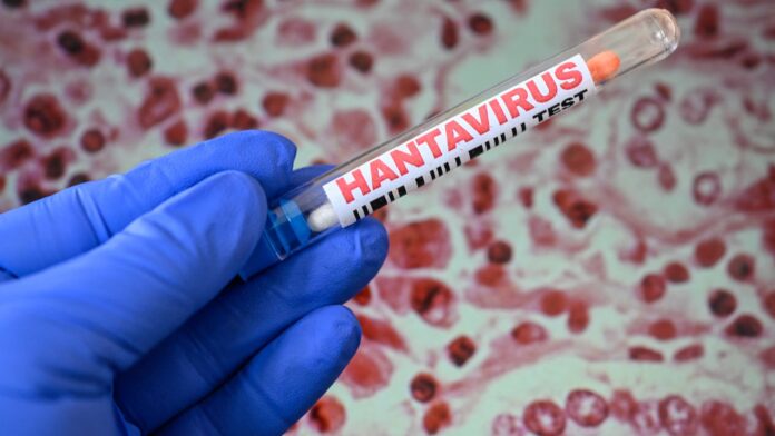 Hantavirus cases spark surge in pharma and biotech stocks — here’s why