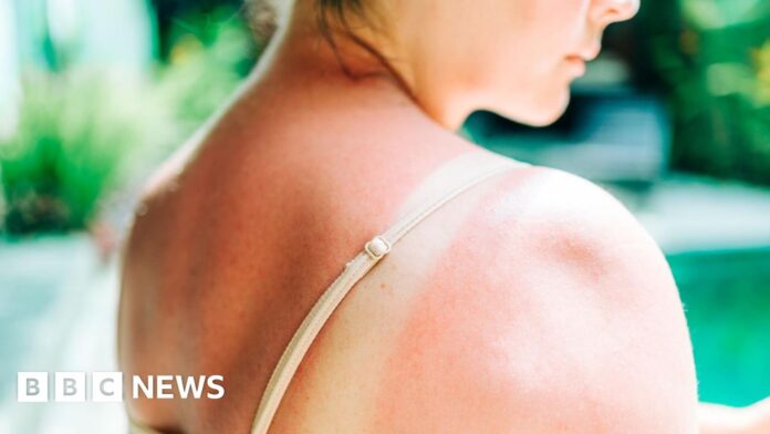 Riskiest skin cancer cases hit UK record high