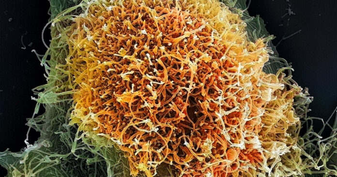 The Viruses Causing New Outbreaks Are Much Less Familiar to Science
