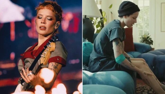 Halsey fires back after critic mocks album about her chemo battle