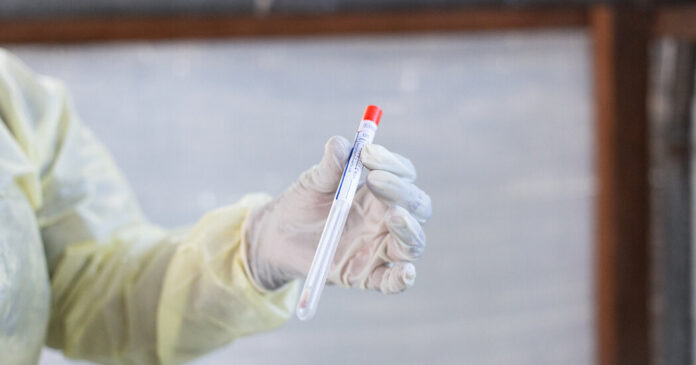 Scientist Charged With Conspiring to Smuggle Mpox Virus Into U.S.