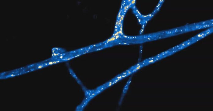 Scientists Measure Earth’s Vast Underground Fungal Webs