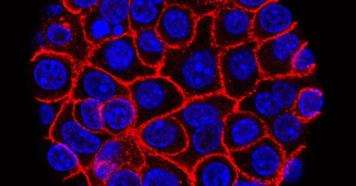 What makes promising pancreatic cancer drug different from chemotherapy?