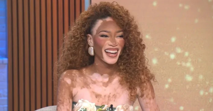 Winnie Harlow on why she centered her new children's book around self-confidence