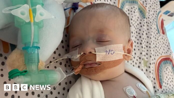 A baby is seen with various tubes and medical equipment attached to him. He is laid on a bed with a white and black dotted pattern and colourful semi circles. 