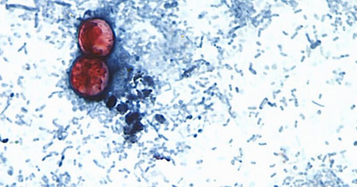 What the Cyclospora Outbreak Reveals