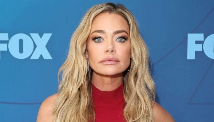 Denise Richards turns furious over lies regarding cosmetic procedures