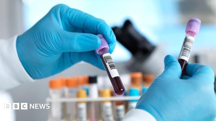 Stock photo shows a lab setting with close up of gloved hands holding tubes of blood with bar codes on them, with other tubes in background with bokeh.