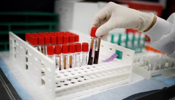Experimental blood test finds high-risk colorectal lesions before cancer develops